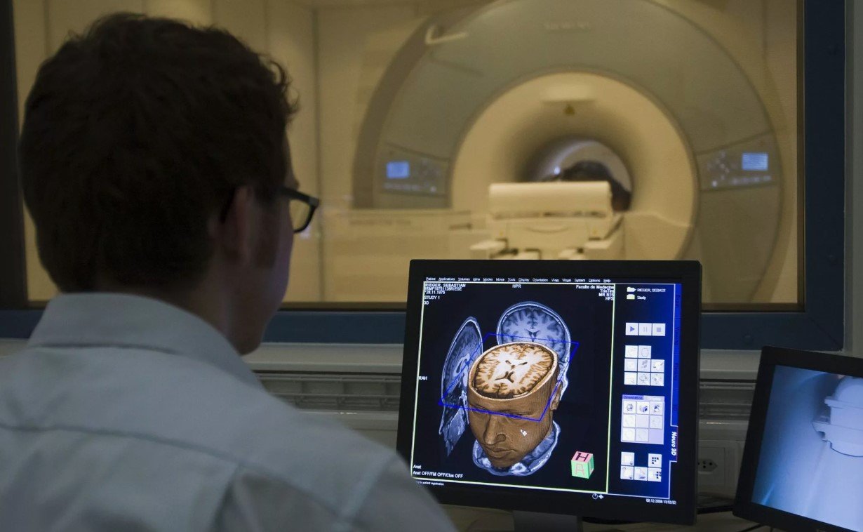 abnormality brain scan