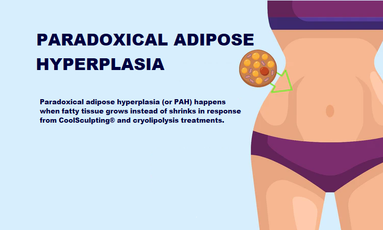 What is Paradoxical Adipose Hyperplasia?